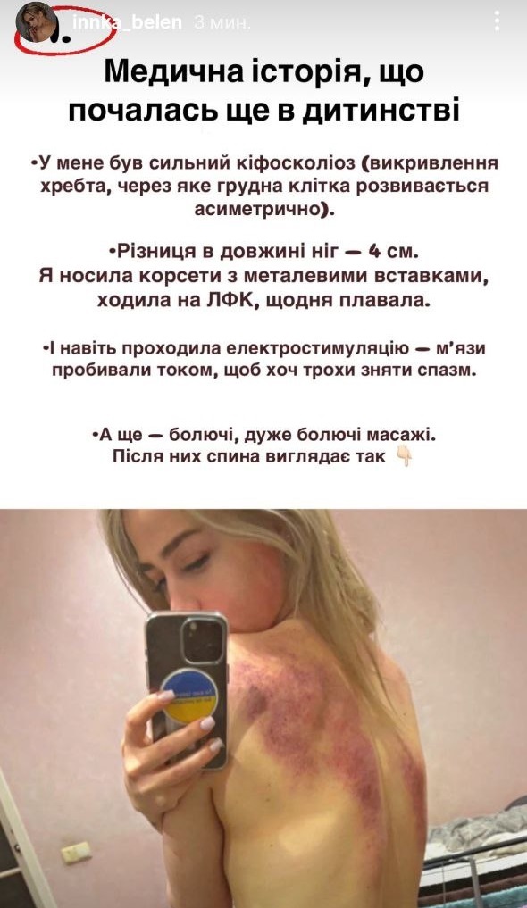 Інна Бєлєнь після довгої паузи перервала мовчання і показалася в лікарні: що відомо